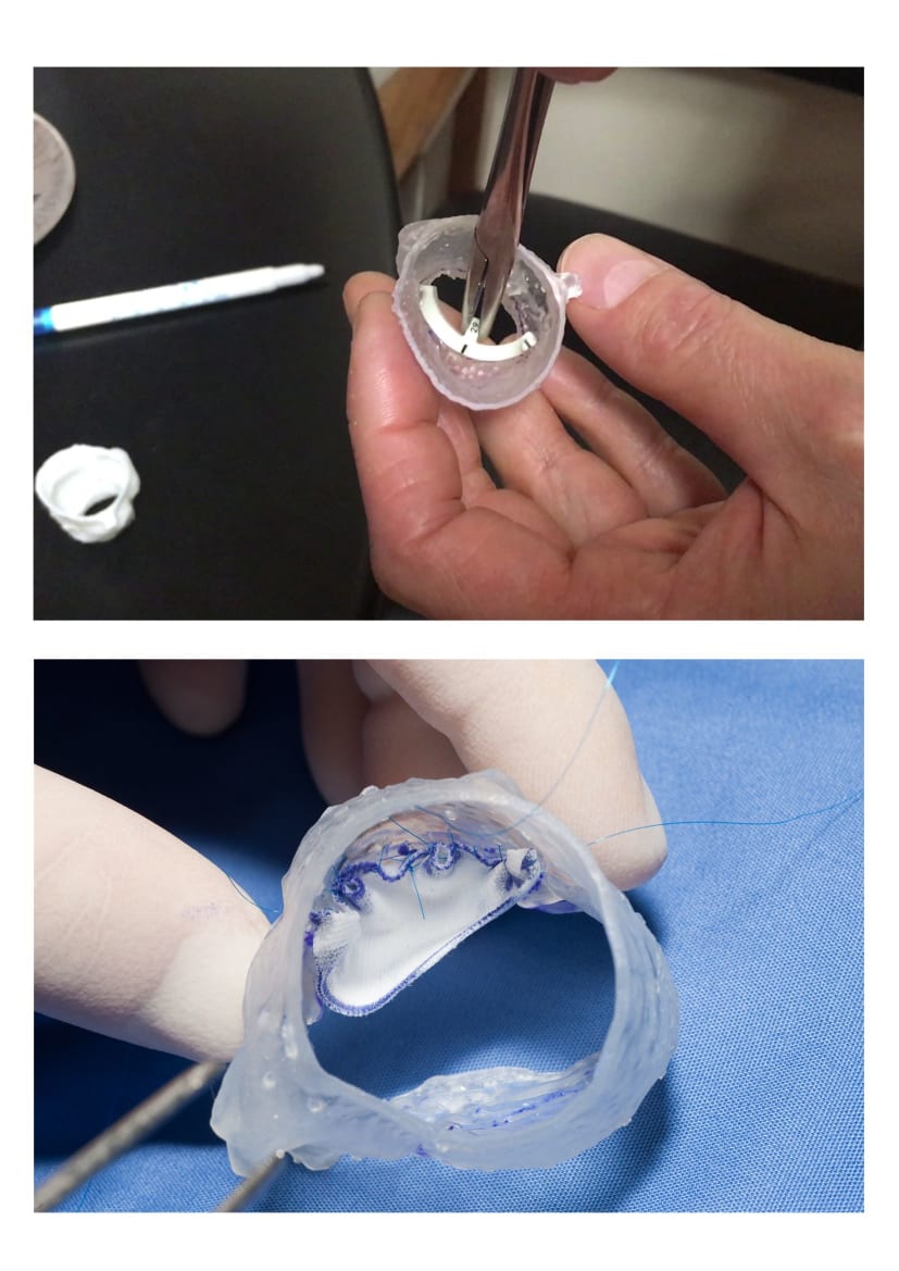 Ozaki heart valve 3D printing