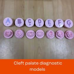 Cleft diagnostic models