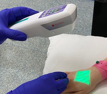 The AccuVein Finder in use